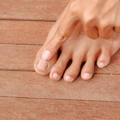 Tira de correção para unha dos pés- Corretor Podal