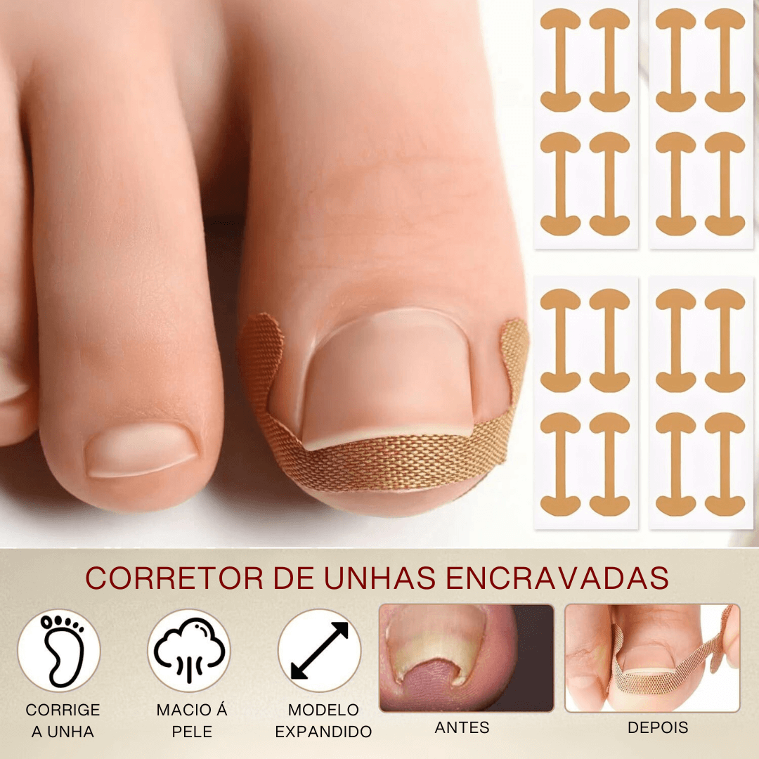 Tira de correção para unha dos pés- Corretor Podal