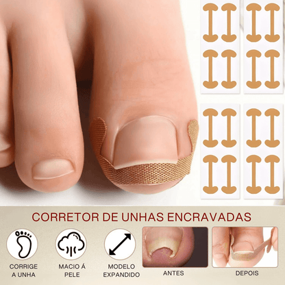 Tira de correção para unha dos pés- Corretor Podal