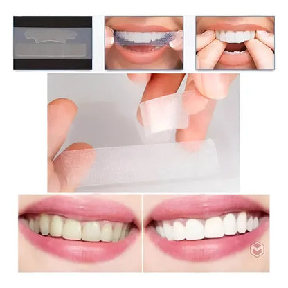 Fita Clareadora Ultra White 9D