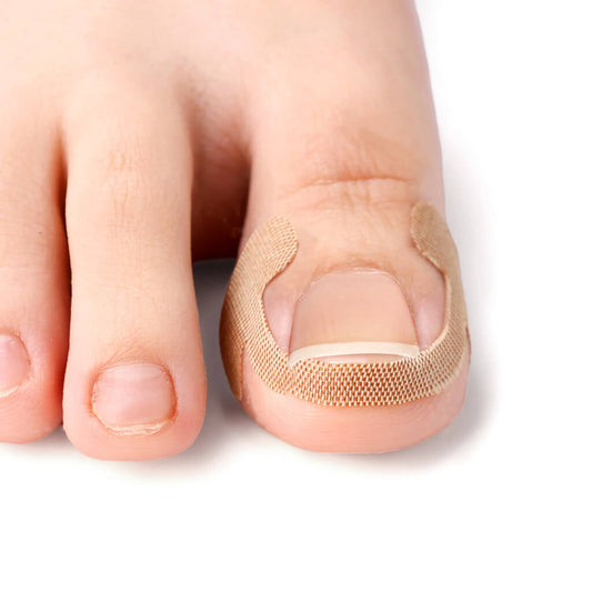 Tira de correção para unha dos pés- Corretor Podal